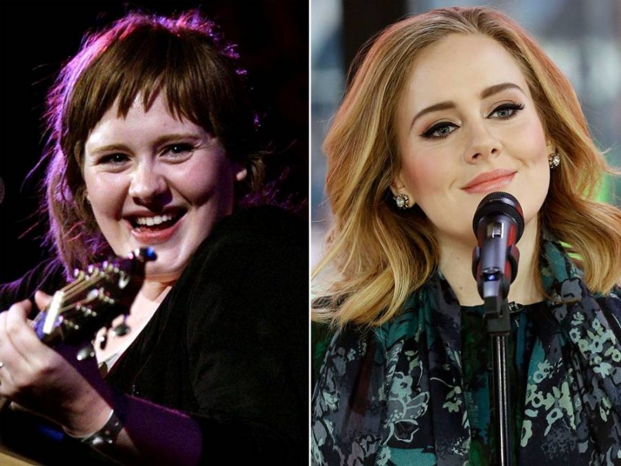 Adele’s Before and After Surgery Photos Show Proof of the Singer’s