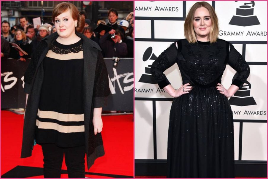 Adele’s Before and After Surgery Photos Show Proof of the Singer’s